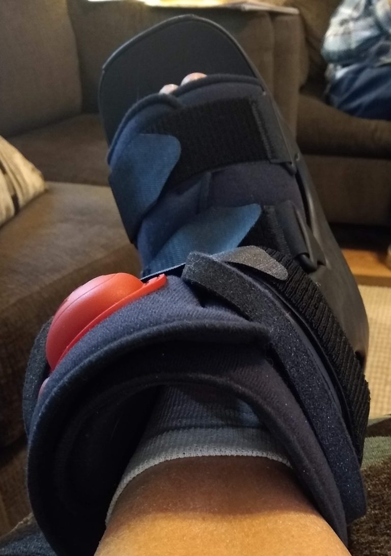 broken foot in a boot